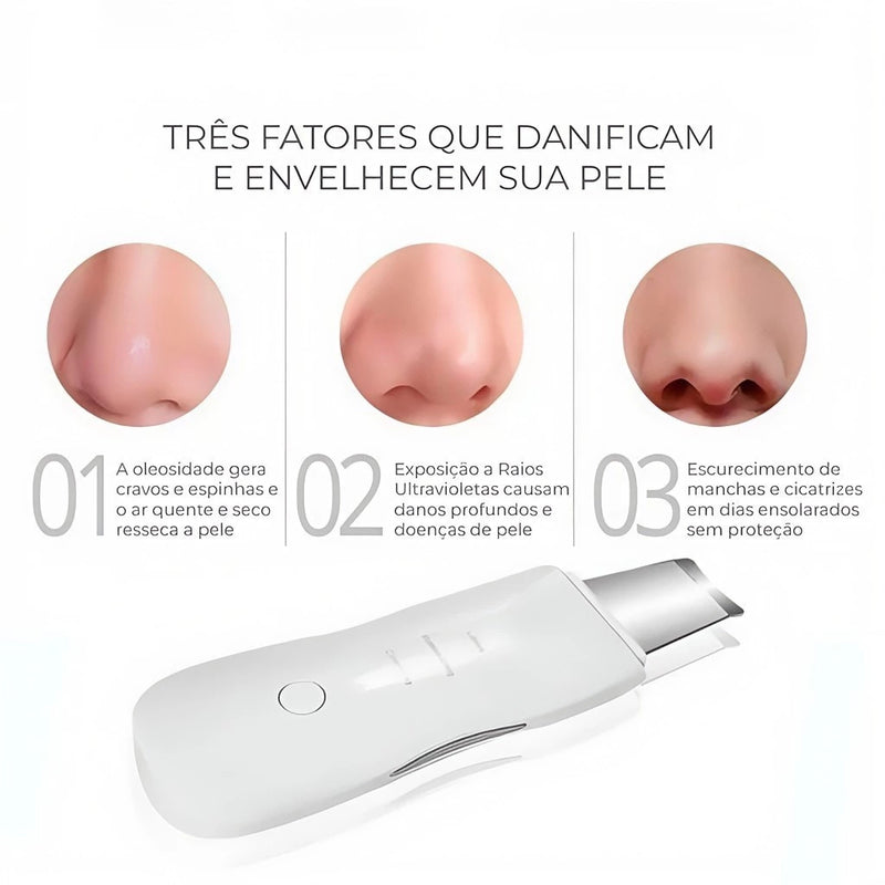 Esfoliador Ultrassônico de Pele: Removedor de Cravos e Limpador Facial com Cavitação