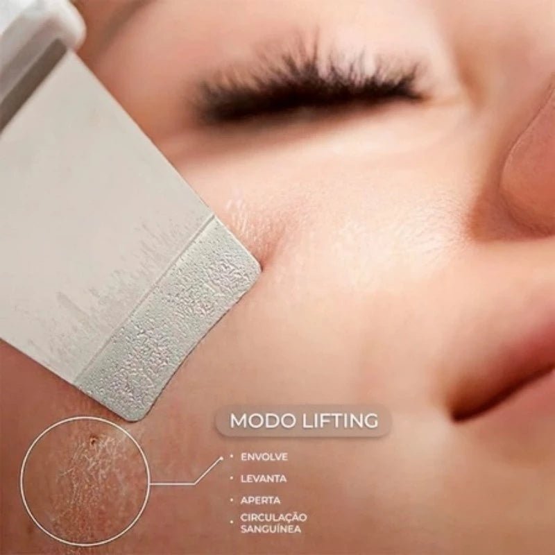 Esfoliador Ultrassônico de Pele: Removedor de Cravos e Limpador Facial com Cavitação